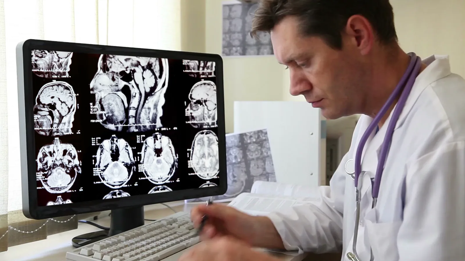 Medical Imaging Sector Reports Slower Q4 2025 Despite Revenue Beat